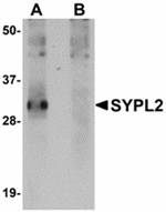 Western blot analysis of SYPL2 in human spleen tissue lysate with SYPL2 antibody at 1 ug/mL in (A) the absence and (B) the presence of blocking peptide.