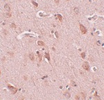 Immunohistochemistry of FAM59B in human brain tissue with FAM59B antibody at 5 ug/mL.