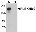 Western blot analysis of PLEKHM2 in rat brain tissue lysate with PLEKHM2 antibody at 0.5 ug/mL in (A) the absence and (B) the presence of blocking peptide.
