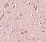 Immunohistochemistry of FAM59A in human liver tissue with FAM59A antibody at 5 ug/mL.