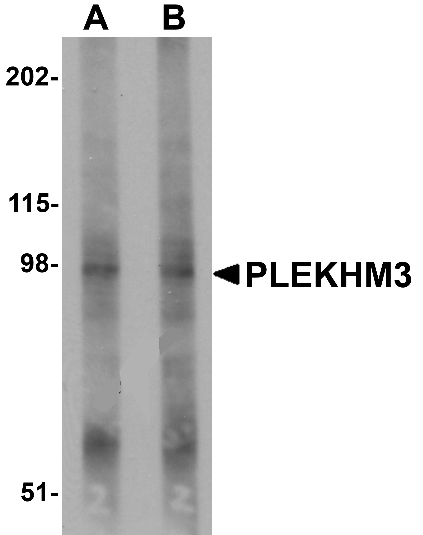 Western blot analysis of PLEKHM3 in mouse skeletal muscle tissue lysate with PLEKHM3 antibody at (A) 1 and (B) 2 ug/mL.