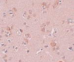 Immunohistochemistry of PLEKHM3 in human brain tissue with PLEKHM3 antibody at 5 ug/mL.