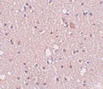 Immunohistochemistry of SIPA1L2 in human brain tissue with SIPA1L2 antibody at 5 ug/mL.