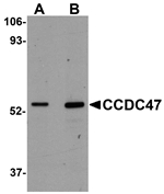 Western blot analysis of CCDC47 in mouse heart tissue lysate with CCDC47 antibody at (A) 1 and (B) 2 ug/mL.