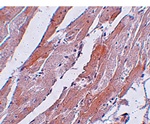 Immunohistochemistry of CCDC47 in mouse heart tissue with CCDC47 antibody at 5 ug/mL.