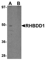 Western blot analysis of RHBDD1 in K562 cell lysate with RHBDD1 antibody at 1 ug/mL in (A) the absence and (B) the presence of blocking peptide.