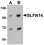 Western blot analysis of SLFN14 in mouse kidney tissue lysate with SLFN14 antibody at (A) 1 and (B) 2 ug/mL.
