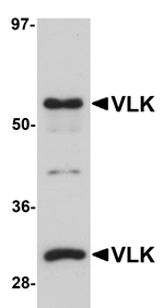 Western blot analysis of VLK in human lung tissue lysate with VLK antibody at 1 ug/mL.