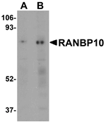 Western blot analysis of RANBP10 in human skeletal muscle tissue lysate with RANBP10 antibody at (A) 1 and (B) 2 ug/mL.