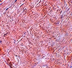 Immunohistochemistry of RANBP10 in human skeletal muscle tissue with RANBP10 antibody at 5 ug/mL.