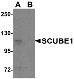 Western blot analysis of SCUBE1 in Daudi cell lysate with SCUBE1 antibody at 1 ug/mL in (A) the absence and (B) the presence of blocking peptide.