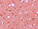 Immunohistochemistry of SESTD1 in human brain tissue with SESTD1 antibody at 5 ug/mL.