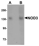Western blot analysis of NOD3 in 3T3 cell lysate with NOD3 antibody at (A) 1 and (B) 2 ug/mL.