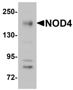 Western blot analysis of NOD4 in EL4 cell lysate with NOD4 antibody at 1 ug/mL.
