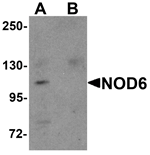 Western blot analysis of NOD6 in EL4 cell lysate with NOD6 antibody at 1 ug/mL in the (A) absence and (B) presence of blocking peptide.
