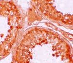 Immunohistochemistry of NOD6 in human testis tissue with NOD6 antibody at 10 ug/mL.