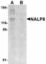 Western blot analysis of NALP8 in human colon tissue lysate with NALP8 antibody at 1 ug/mL in (A) the absence and (B) the presence of blocking peptide.