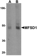 Western blot analysis of MFSD1 in human lung tissue lysate with MFSD1 antibody at (A) 1 and (B) 2 ug/mL.