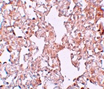 Immunohistochemistry of MFSD1 in rat lung tissue with MFSD1 antibody at 10 ug/mL.