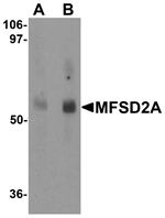 Western blot analysis of MFSD2A in rat lung tissue lysate with MFSD2A antibody at (A) 1 and (B) 2 ug/mL.