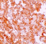 Immunohistochemistry of MFSD2A in rat lung tissue with MFSD2A antibody at 5 ug/mL.