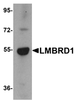 Western blot analysis of LMBRD1 in human brain tissue lysate with LMBRD1 antibody at 1 ug/mL.