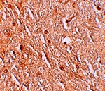 Immunohistochemistry of LMBRD1 in human brain tissue with LMBRD1 antibody at 2.5 ug/mL.