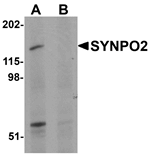 Western blot analysis of SYNPO2 in human skeletal muscle tissue lysate with SYNPO2 antibody at 1 ug/mL in (A) the absence and (B) the presence of blocking peptide.