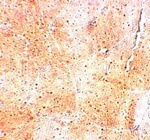 Immunohistochemistry of SYNPO2 in mouse skeletal muscle tissue with SYNPO2 antibody at 5 ug/mL.