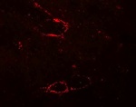Immunohistochemistry of SYNPO2L in mouse skeletal muscle tissue with SYNPO2L antibody at 5 ug/mL.