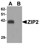 Western blot analysis of ZIP2 in rat brain tissue lysate with ZIP2 antibody at 1 ug/mL in (A) the absence and (B) the presence of blocking peptide.