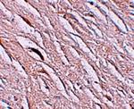 Immunohistochemistry of ZIP2 in human brain tissue with ZIP2 antibody at 2.5 ug/mL.