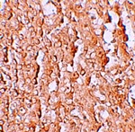 Immunohistochemistry of ZIP10 in human spleen tissue with ZIP10 antibody at 2.5 ug/mL.
