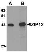 Western blot analysis of ZIP12 in HepG2 cell lysate with ZIP12 antibody at (A) 0.5 and (B) 1 ug/mL.
