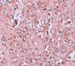 Immunohistochemistry of ZIP13 in human spleen tissue with ZIP13 antibody at 2.5 ug/mL.