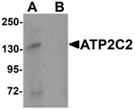 Western blot analysis of ATP2C2 in 3T3 cell lysate with ATP2C2 antibody at 1 ug/mL in (A) the absence and (B) the presence of blocking peptide