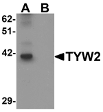 Western blot analysis of TYW2 in K562 cell lysate with TYW2 antibody at 0.5 ug/mL in (A) the absence and (B) the presence of blocking peptide.