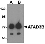 Western blot analysis of ATAD3B in human kidney tissue lysate with ATAD3B antibody at (A) 1 and (B) 2 ug/mL .