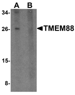 Western blot analysis of TMEM88 in human brain tissue lysate with TMEM88 antibody at 1 ug/mL in (A) the absence and (B) the presence of blocking peptide.