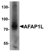 Western blot analysis of AFAP1L1 in A549 cell lysate with AFAP1L1 antibody at 1 ug/mL.
