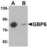 Western blot analysis of GBP6 in Hela cell lysate with GBP6 antibody at 0.5 ug/mL in (A) the absence and (B) the presence of blocking peptide.