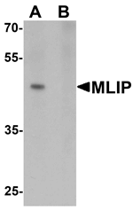 Western blot analysis of MLIP in 293 cell lysate with MLIP antibody at 1 ug/mL in (A) the absence and (B) the presence of blocking peptide.