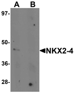 Western blot analysis of NKX2-4 in A20 cell lysate with NKX2-4 antibody at 1 ug/mL in (A) the absence and (B) the presence of blocking peptide.