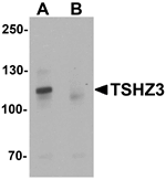 Western blot analysis of TSHZ3 in mouse brain tissue lysate with TSHZ3 antibody at 1 ug/mL in (A) the absence and (B) the presence of blocking peptide.