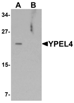 Western blot analysis of YPEL4 in SW480 cell lysate with YPEL4 antibody at 1 ug/mL in (A) the absence and (B) the presence of blocking peptide.