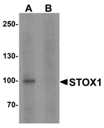 Western blot analysis of STOX1 in human liver tissue lysate with STOX1 antibody at 1 ug/ml in (A) the absence and (B) the presence of blocking peptide.