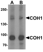 Western blot analysis of COH1 in SK-N-SH cell lysate with COH1 antibody at (A) 1 and (B) 2 ug/ml.