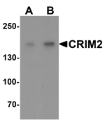 Western blot analysis of CRIM2 in Jurkat cell lysate with CRIM2 antibody at (A) 1 and (B) 2 ug/ml.