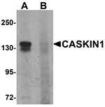 Western blot analysis of CASKIN1 in HeLa cell lysate with CASKIN1 antibody at 1 ug/ml in (A) the absence and (B) the presence of blocking peptide.