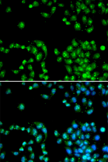 Immunofluorescence analysis of HeLa cell using POLR2L antibody. Blue: DAPI for nuclear staining.